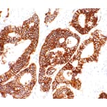 Immunohistochemistry - Anti-LI Cadherin Antibody [IHC520] (A324543) - Antibodies.com