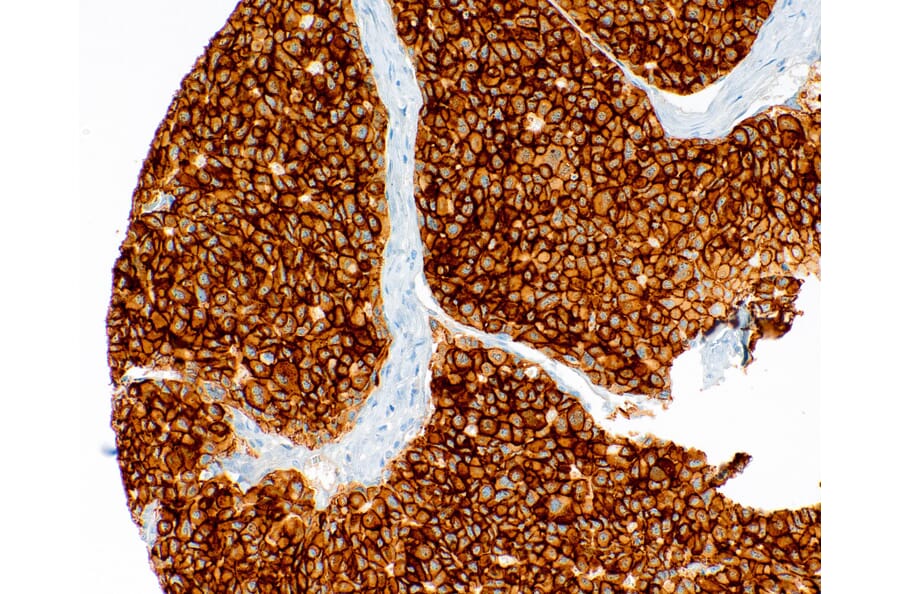 Immunohistochemistry - Anti-Met (c-Met) Antibody [IHC078] (A324545) - Antibodies.com