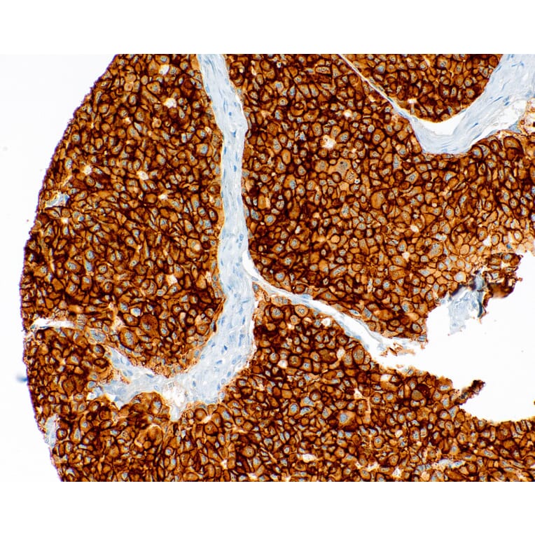 Immunohistochemistry - Anti-Met (c-Met) Antibody [IHC078] (A324545) - Antibodies.com
