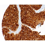 Immunohistochemistry - Anti-Met (c-Met) Antibody [IHC078] (A324545) - Antibodies.com