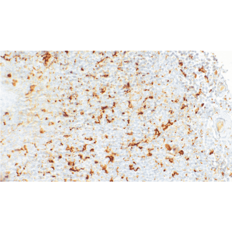 Immunohistochemistry - Anti-MMP9 Antibody [IHC109] (A324546) - Antibodies.com