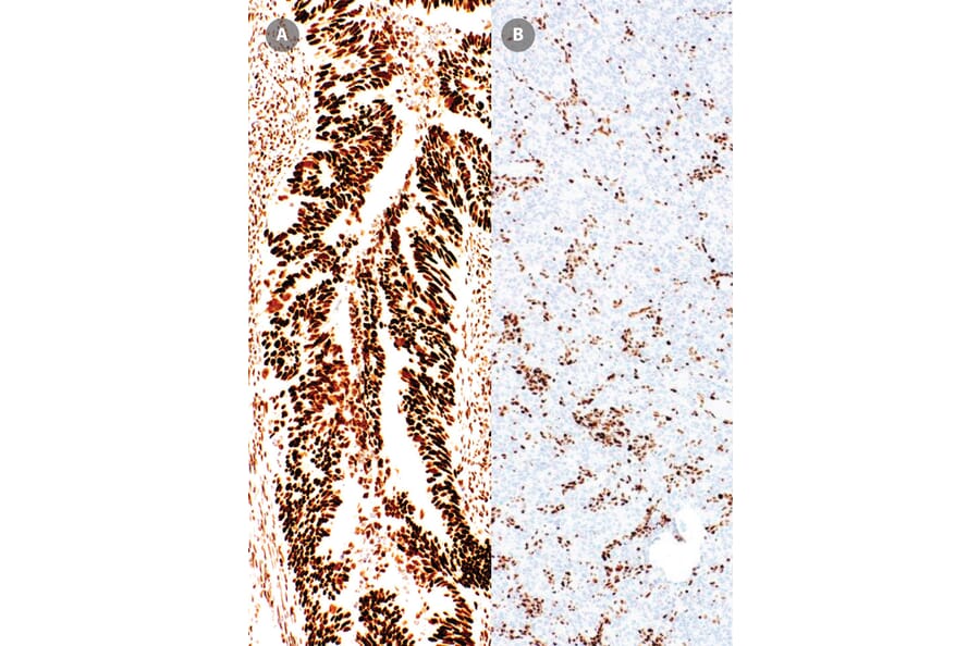 Immunohistochemistry - Anti-MSH6 Antibody [IHC026] (A324547) - Antibodies.com