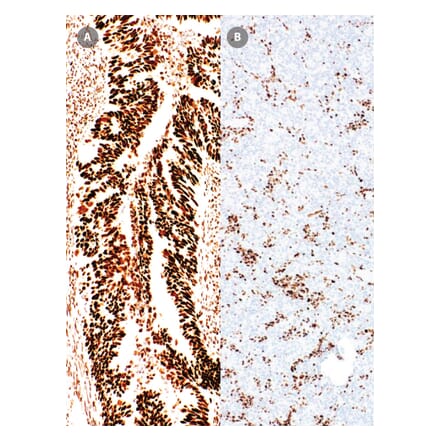Immunohistochemistry - Anti-MSH6 Antibody [IHC026] (A324547) - Antibodies.com