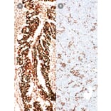 Immunohistochemistry - Anti-MSH6 Antibody [IHC026] (A324547) - Antibodies.com