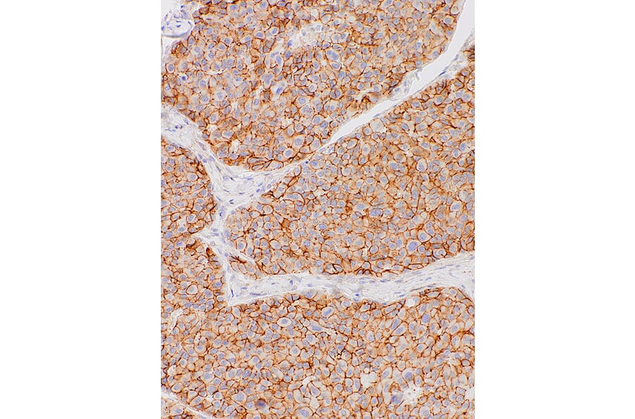 Immunohistochemistry - Anti-N Cadherin Antibody [IHC736] (A324548) - Antibodies.com