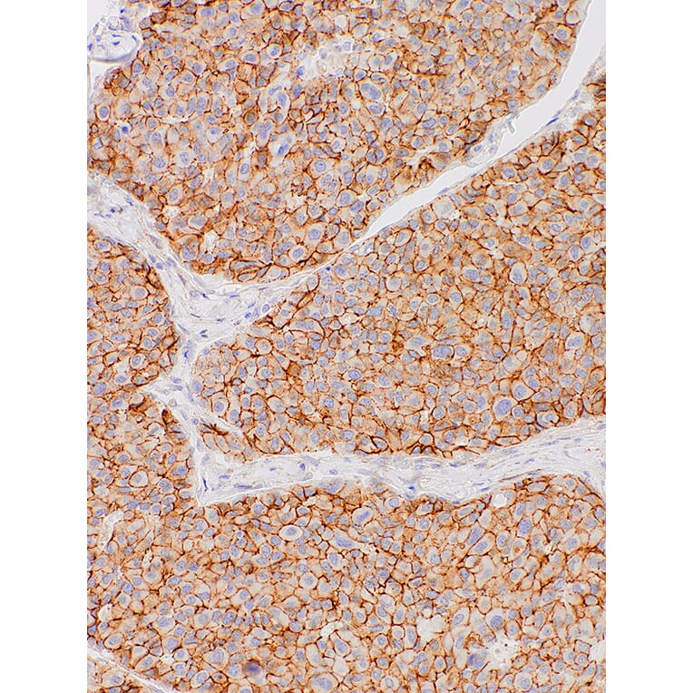 Immunohistochemistry - Anti-N Cadherin Antibody [IHC736] (A324548) - Antibodies.com