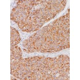 Immunohistochemistry - Anti-N Cadherin Antibody [IHC736] (A324548) - Antibodies.com