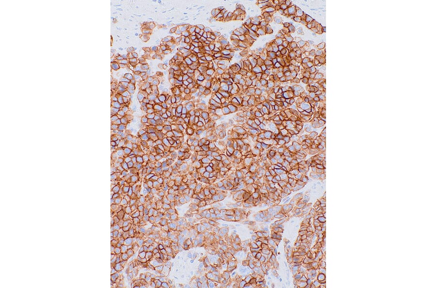 Immunohistochemistry - Anti-NCAM1 Antibody [IHC066] (A324549) - Antibodies.com