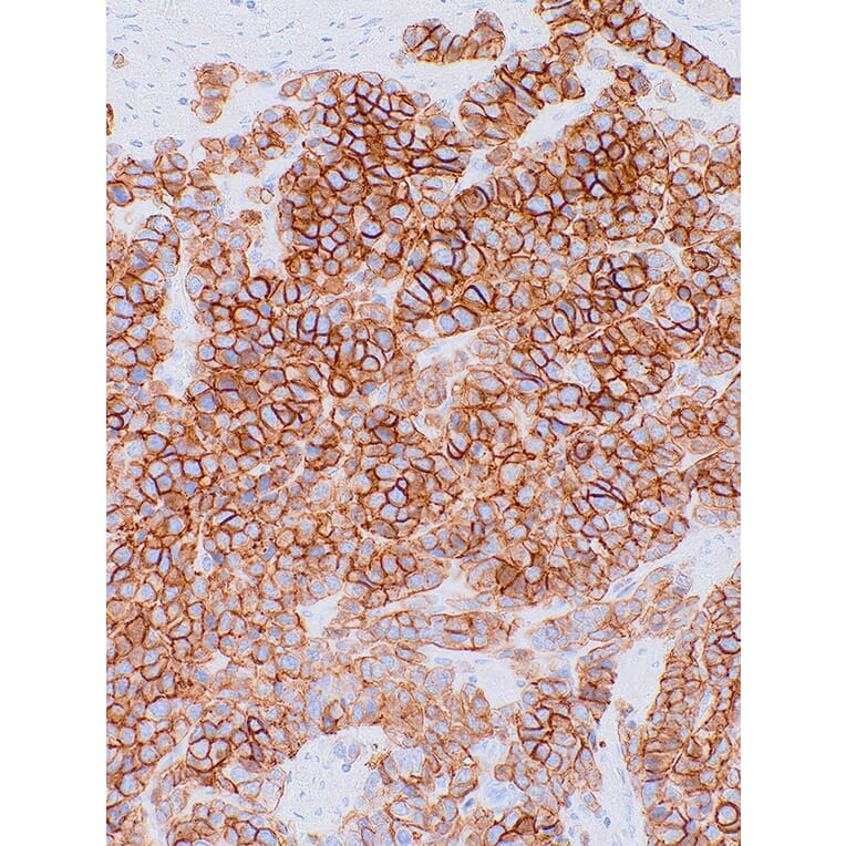 Immunohistochemistry - Anti-NCAM1 Antibody [IHC066] (A324549) - Antibodies.com
