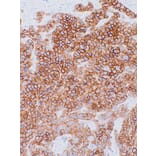 Immunohistochemistry - Anti-NCAM1 Antibody [IHC066] (A324549) - Antibodies.com