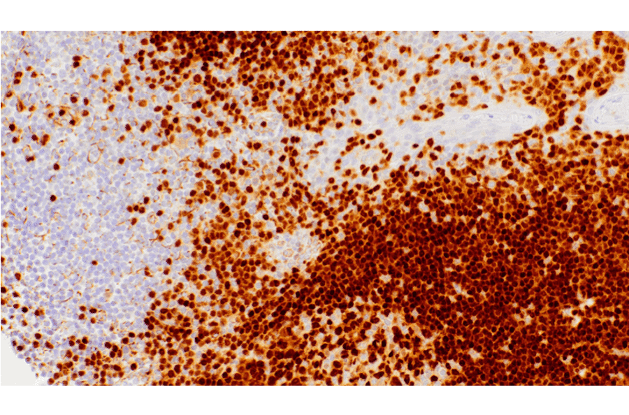 Immunohistochemistry - Anti-PAX5 Antibody [IHC115] (A324550) - Antibodies.com