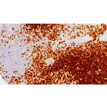 Immunohistochemistry - Anti-PAX5 Antibody [IHC115] (A324550) - Antibodies.com