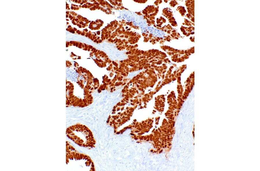 Immunohistochemistry - Anti-PAX8 Antibody [IHC048] (A324551) - Antibodies.com