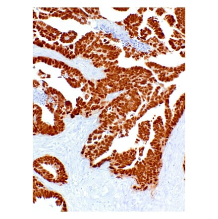 Immunohistochemistry - Anti-PAX8 Antibody [IHC048] (A324551) - Antibodies.com