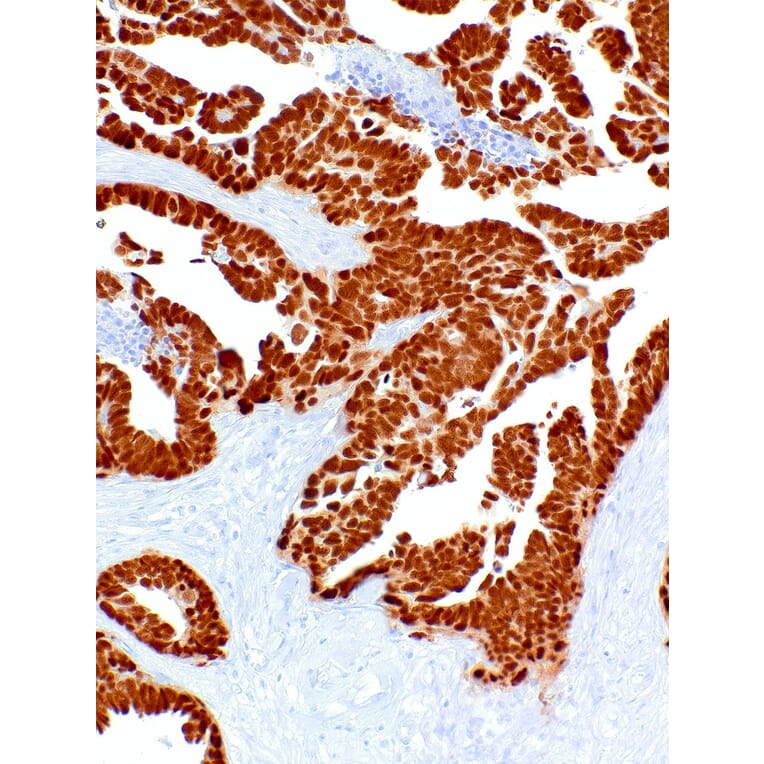 Immunohistochemistry - Anti-PAX8 Antibody [IHC048] (A324551) - Antibodies.com