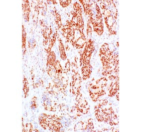 Immunohistochemistry - Anti-PMS2 Antibody [IHC422] (A324552) - Antibodies.com