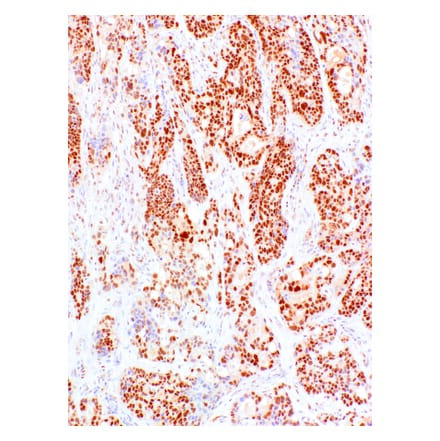 Immunohistochemistry - Anti-PMS2 Antibody [IHC422] (A324552) - Antibodies.com