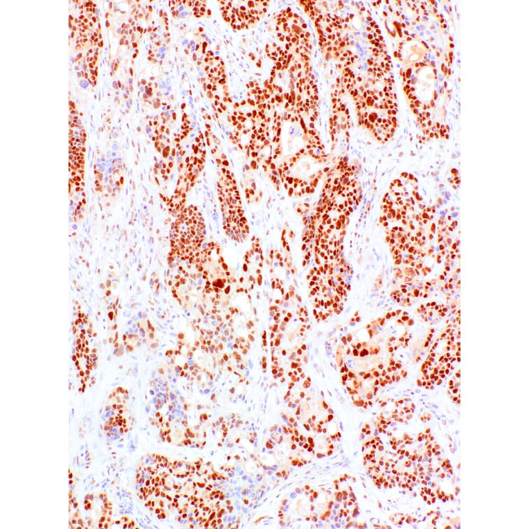 Immunohistochemistry - Anti-PMS2 Antibody [IHC422] (A324552) - Antibodies.com