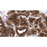 Immunohistochemistry - Anti-PSMA Antibody [IHC720] (A324553) - Antibodies.com