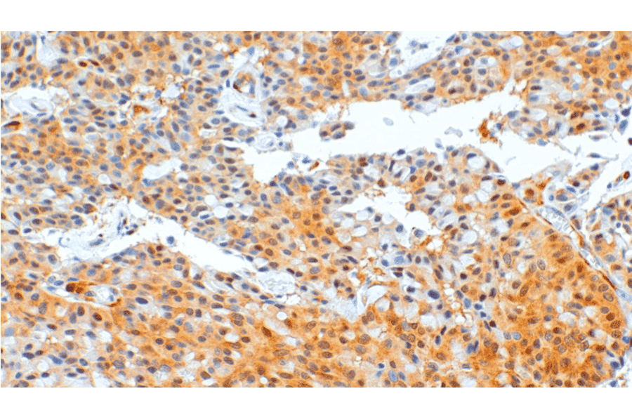 Immunohistochemistry - Anti-PTEN Antibody [IHC110] (A324554) - Antibodies.com