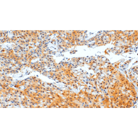 Immunohistochemistry - Anti-PTEN Antibody [IHC110] (A324554) - Antibodies.com