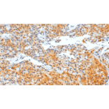 Immunohistochemistry - Anti-PTEN Antibody [IHC110] (A324554) - Antibodies.com