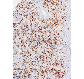 Immunohistochemistry - Anti-TdT Antibody [IHC771] (A324555) - Antibodies.com