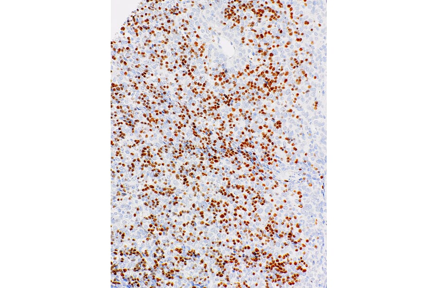 Immunohistochemistry - Anti-TdT Antibody [IHC771] (A324555) - Antibodies.com