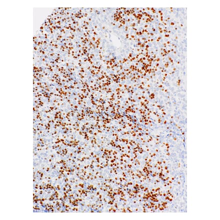 Immunohistochemistry - Anti-TdT Antibody [IHC771] (A324555) - Antibodies.com