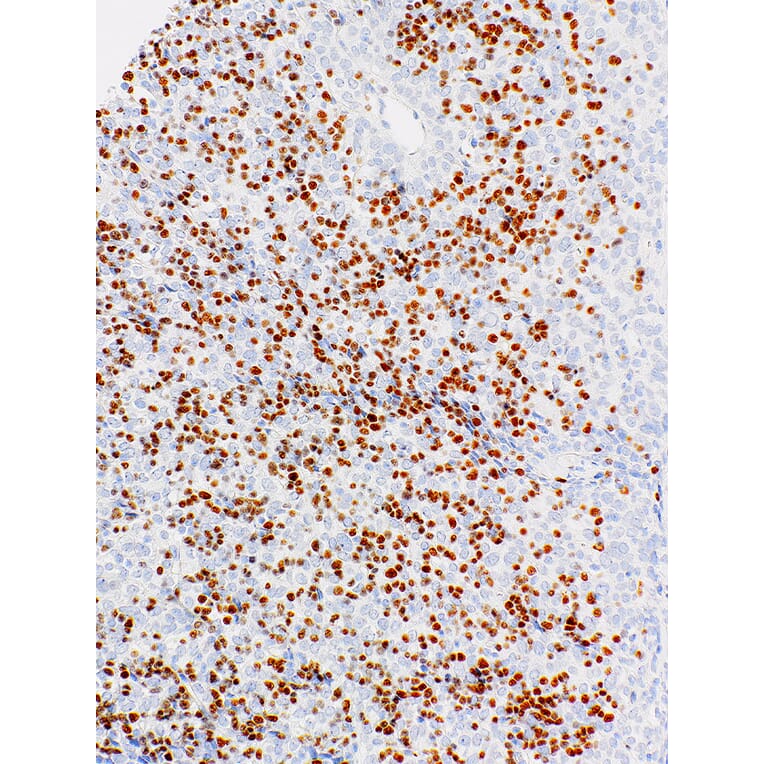 Immunohistochemistry - Anti-TdT Antibody [IHC771] (A324555) - Antibodies.com
