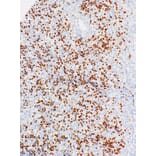 Immunohistochemistry - Anti-TdT Antibody [IHC771] (A324555) - Antibodies.com
