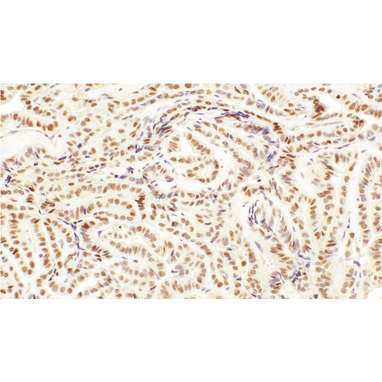 Immunohistochemistry - Anti-TFE3 Antibody [IHC108] (A324556) - Antibodies.com