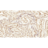 Immunohistochemistry - Anti-TFE3 Antibody [IHC108] (A324556) - Antibodies.com