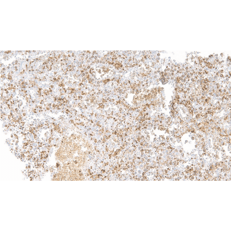 Immunohistochemistry - Anti-TGF beta 1 Antibody [IHC673] (A324557) - Antibodies.com