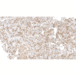 Immunohistochemistry - Anti-TGF beta 1 Antibody [IHC673] (A324557) - Antibodies.com