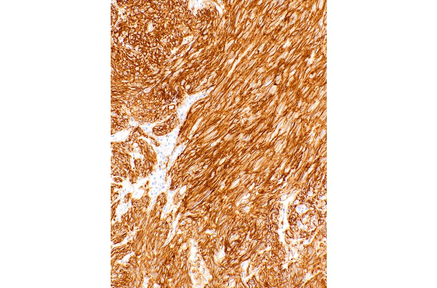 Immunohistochemistry - Anti-TMEM16A Antibody [IHC462] (A324558) - Antibodies.com