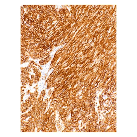 Immunohistochemistry - Anti-TMEM16A Antibody [IHC462] (A324558) - Antibodies.com