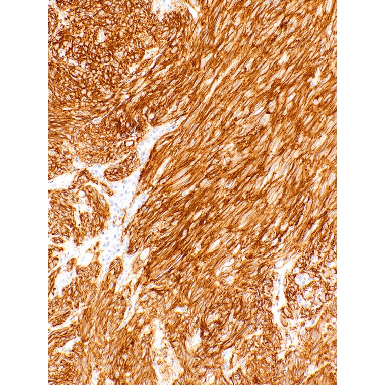 Immunohistochemistry - Anti-TMEM16A Antibody [IHC462] (A324558) - Antibodies.com