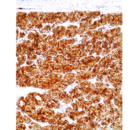 Immunohistochemistry - Anti-Calcitonin Antibody [IHC521] (A324562) - Antibodies.com