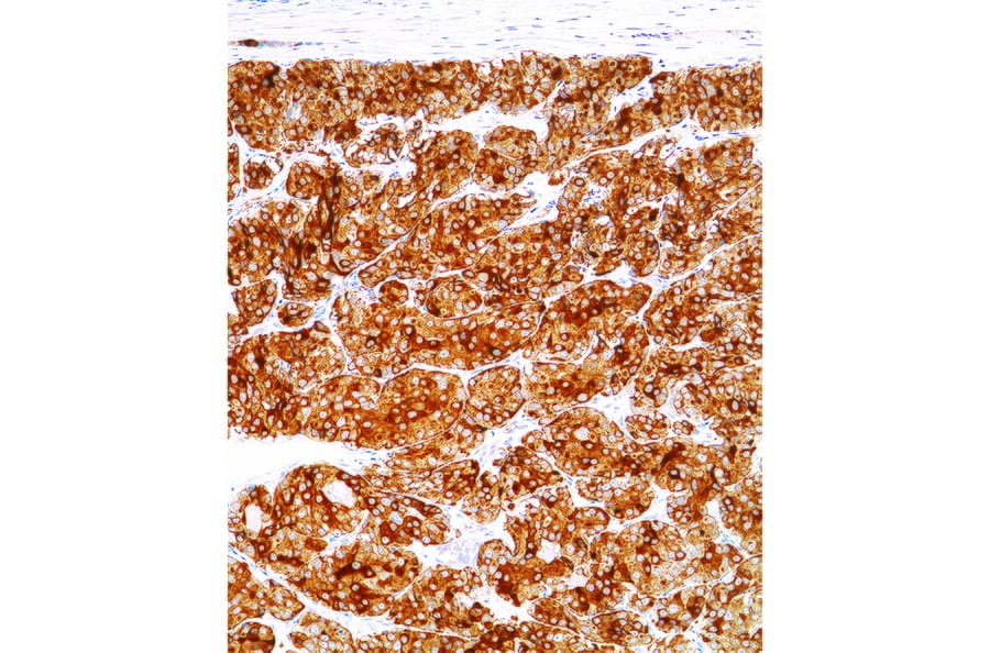 Immunohistochemistry - Anti-Calcitonin Antibody [IHC521] (A324562) - Antibodies.com