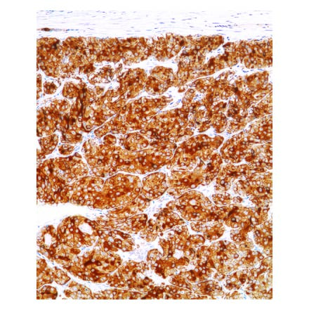 Immunohistochemistry - Anti-Calcitonin Antibody [IHC521] (A324562) - Antibodies.com