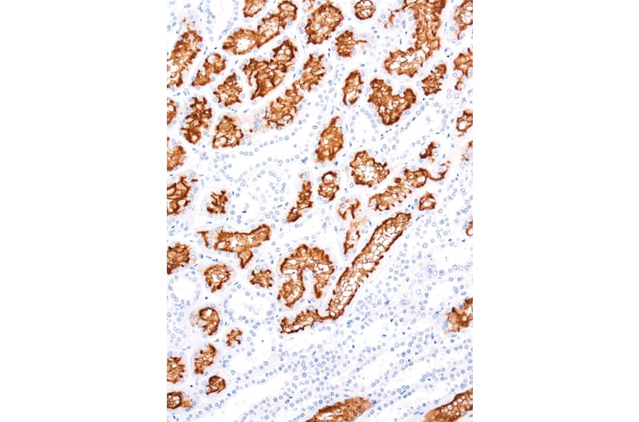 Immunohistochemistry - Anti-CD10 Antibody [IHC525] (A324563) - Antibodies.com