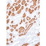 Immunohistochemistry - Anti-CD10 Antibody [IHC525] (A324563) - Antibodies.com
