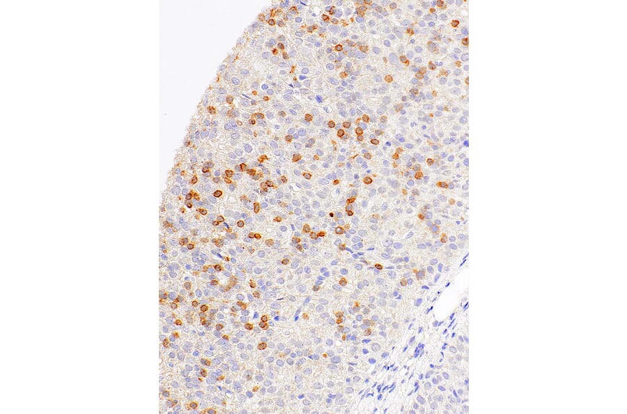 Immunohistochemistry - Anti-CD1a Antibody [IHC530] (A324564) - Antibodies.com