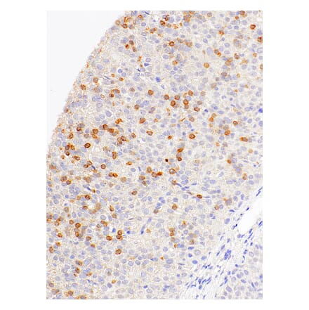 Immunohistochemistry - Anti-CD1a Antibody [IHC530] (A324564) - Antibodies.com
