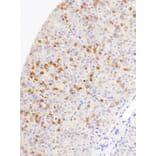 Immunohistochemistry - Anti-CD1a Antibody [IHC530] (A324564) - Antibodies.com