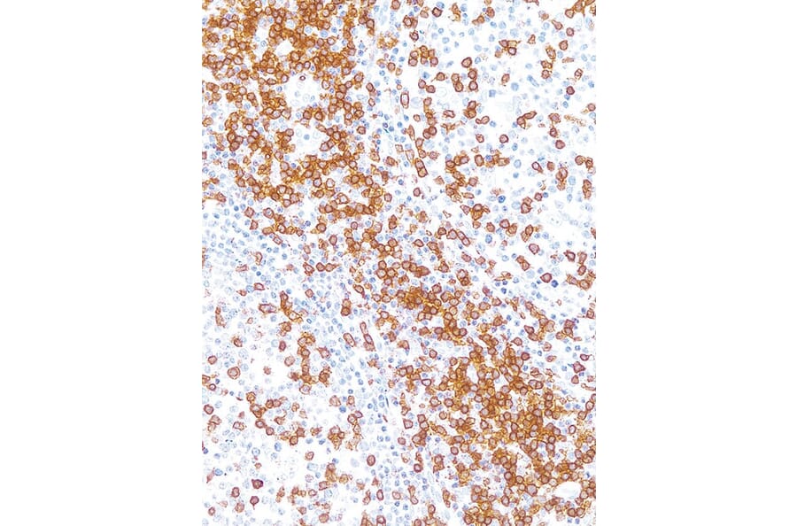 Immunohistochemistry - Anti-CD3 Antibody [IHC534] (A324565) - Antibodies.com