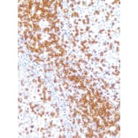 Immunohistochemistry - Anti-CD3 Antibody [IHC534] (A324565) - Antibodies.com