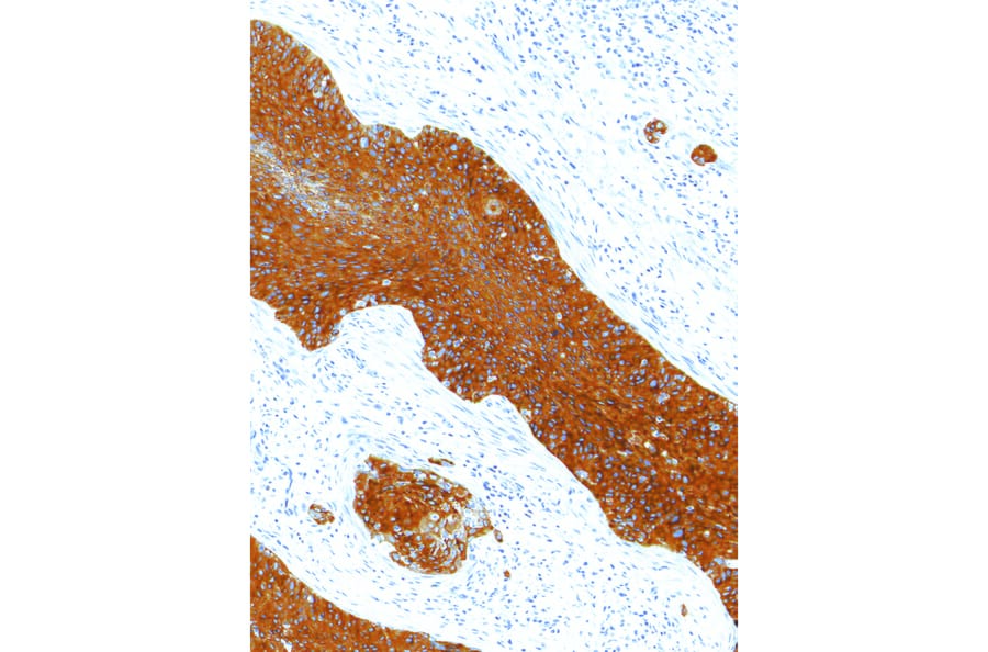 Immunohistochemistry - Anti-delta 1 Catenin/CAS Antibody [IHC120] (A324566) - Antibodies.com