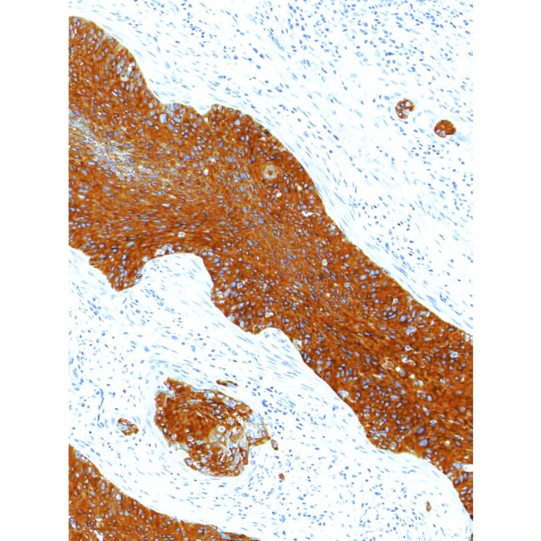 Immunohistochemistry - Anti-delta 1 Catenin/CAS Antibody [IHC120] (A324566) - Antibodies.com